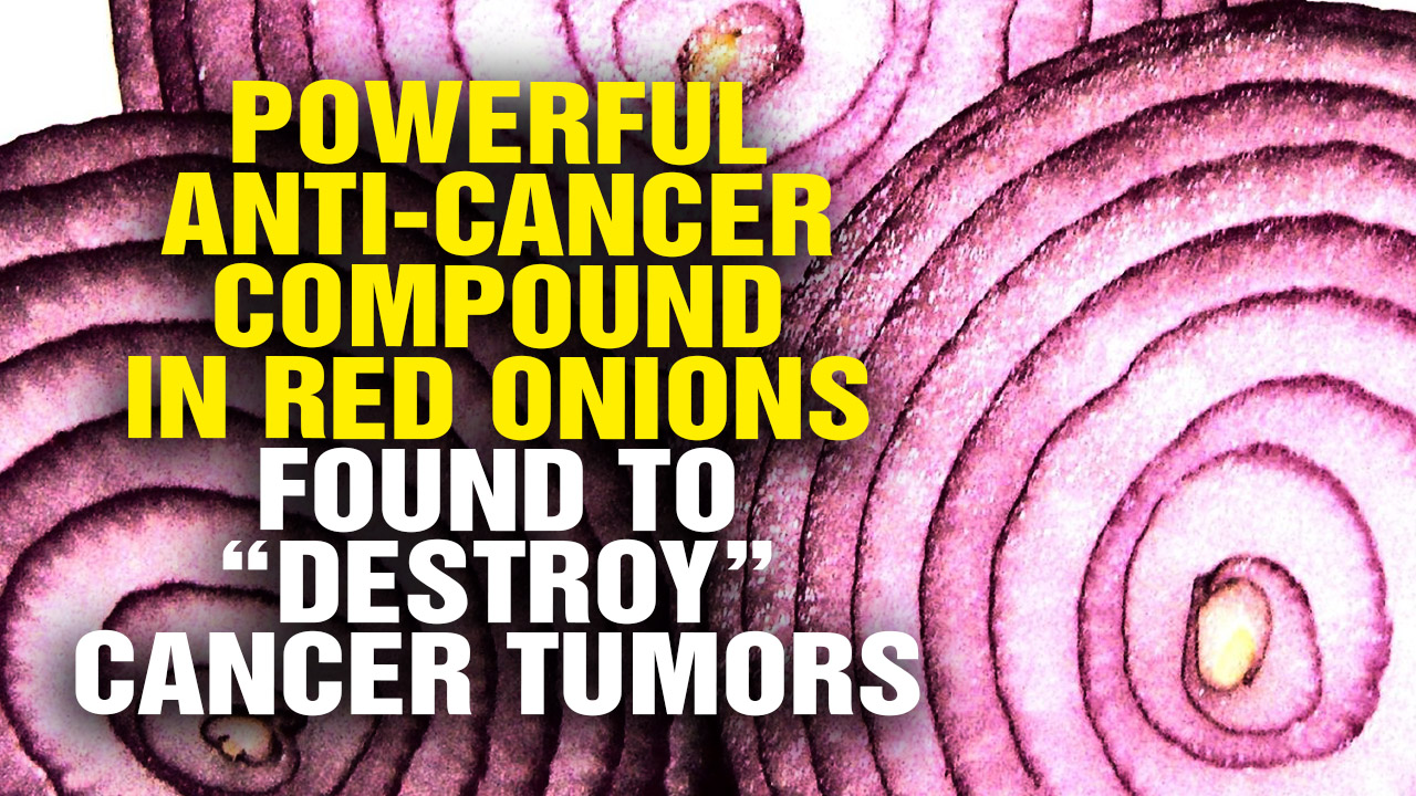 Image: Powerful Anti-Cancer Compound in Red Onions Found To “Destroy” Cancer Tumors (Video)