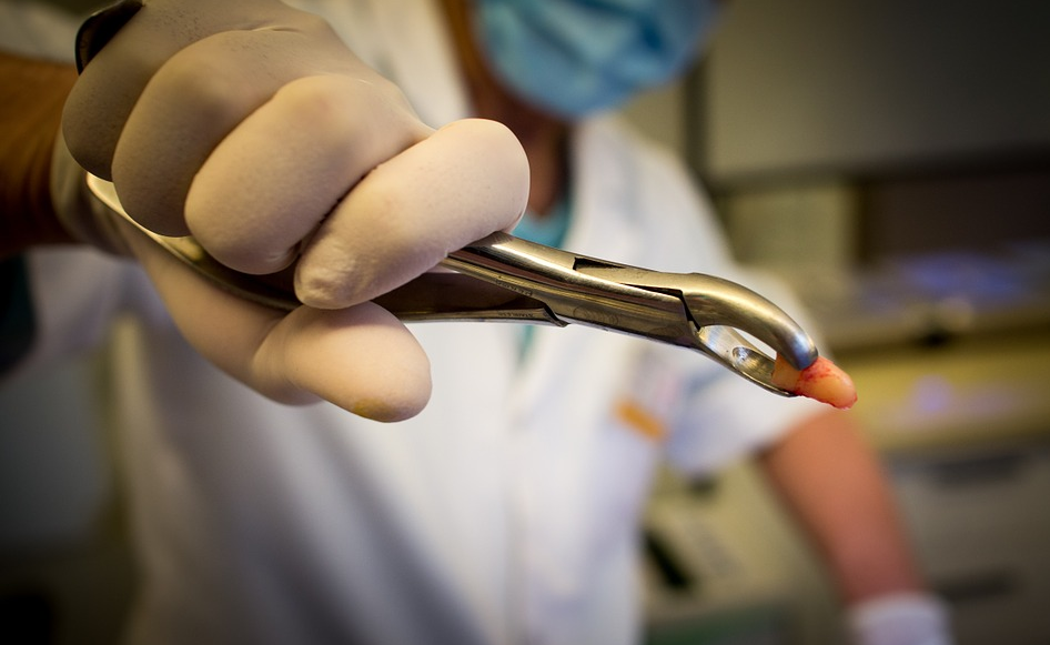 Image: Michigan woman dies after having 16 teeth removed during trip to the dentist! (Audio)
